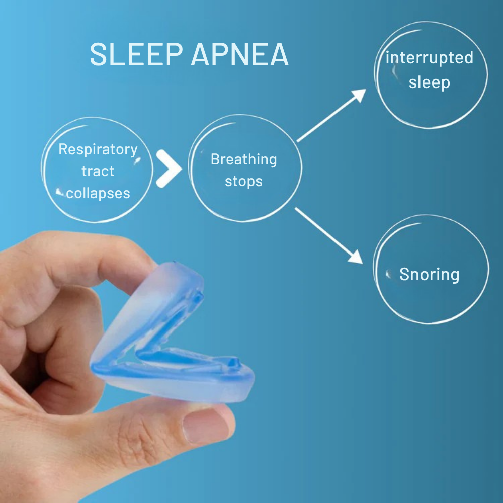 SnoreShield™ - Anti-Snoring Mouthguard
