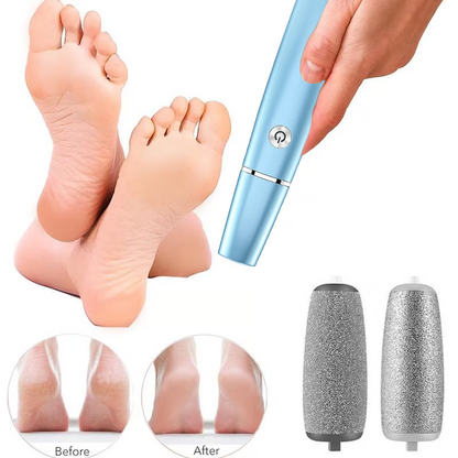 SoftSteps™ Electric Foot File – Christmas Sale 50% OFF 🎄