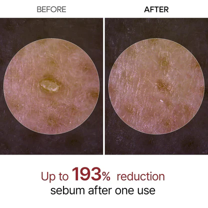 Calmistry™ PeelShot Rice Glow Ampoule Duo
