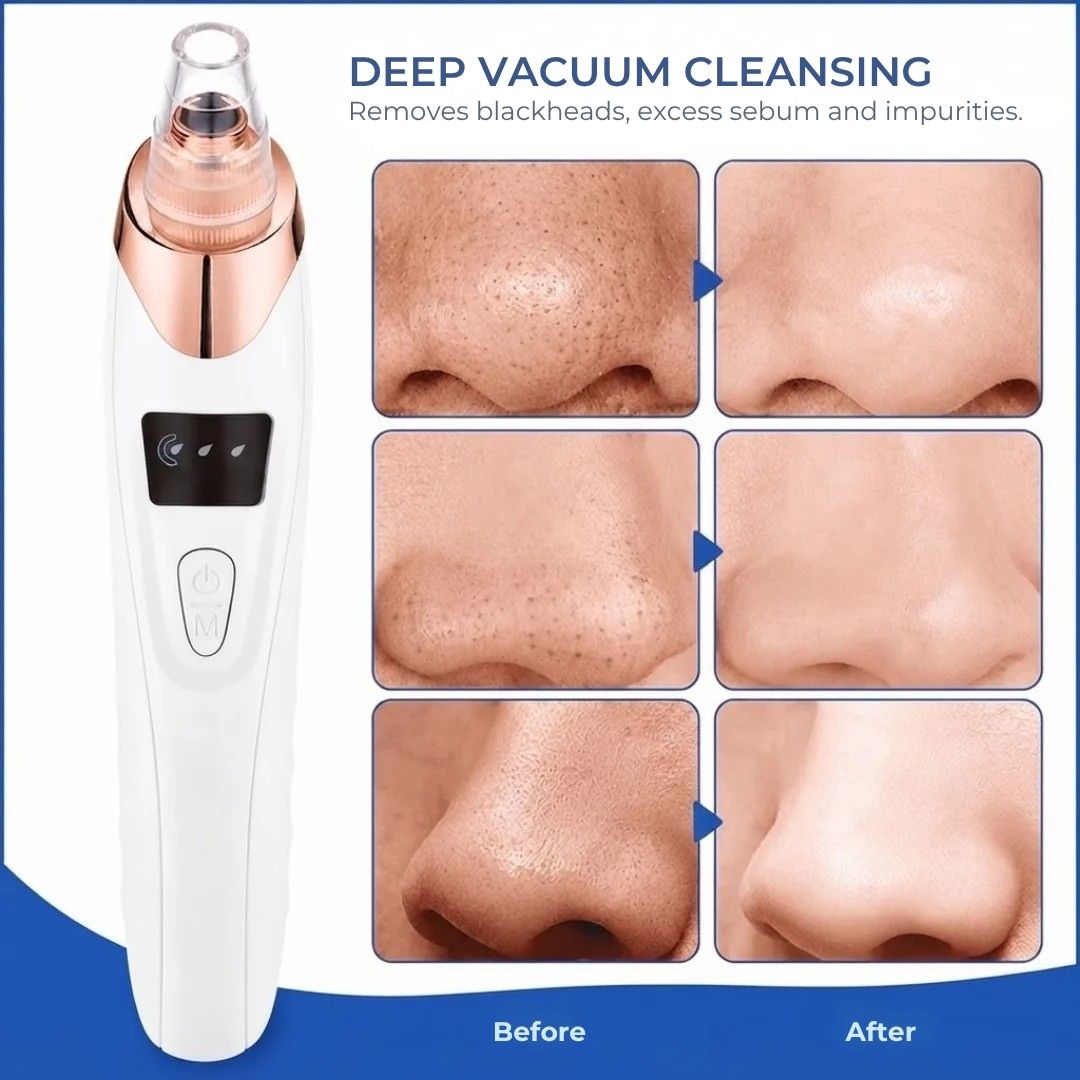 ClearPore™ - Cordless Blackhead & Pore Cleaner