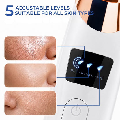 ClearPore™ - Cordless Blackhead & Pore Cleaner