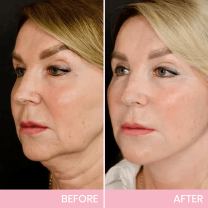 Invisible V-Line Face Lifting Tape