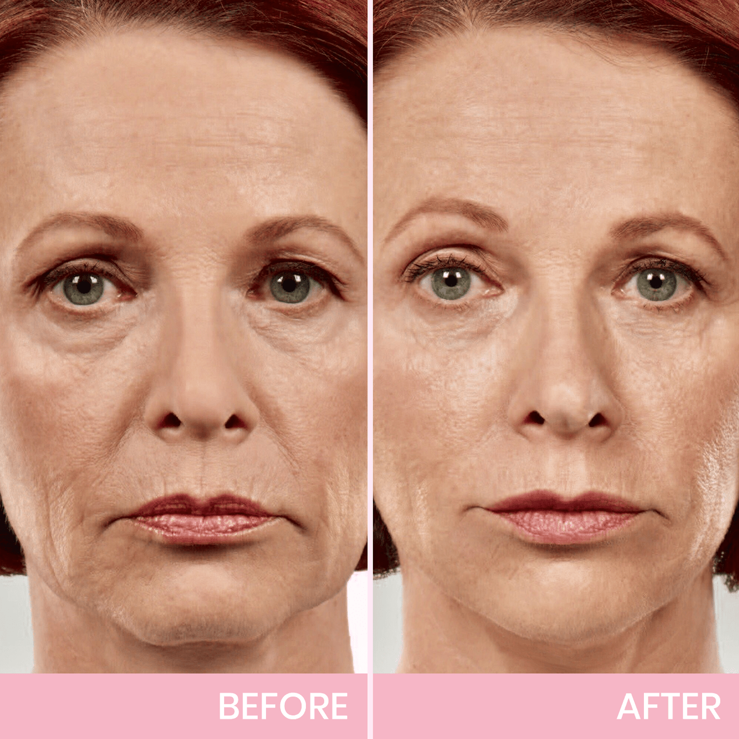 Invisible V-Line Face Lifting Tape
