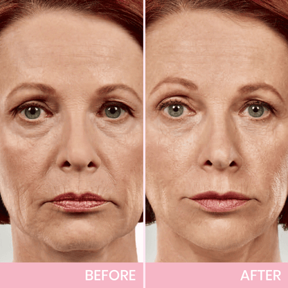 Invisible V-Line Face Lifting Tape