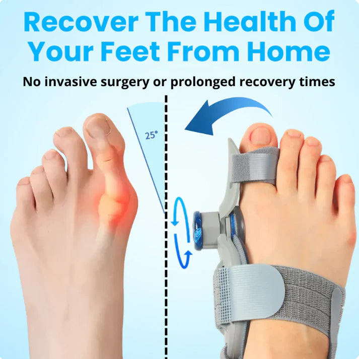 Calmistry™ - BunionFix - Non-Surgical Relief for Bunion Pain