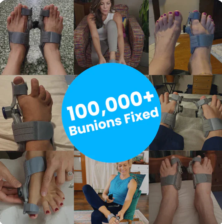 Calmistry™ - BunionFix - Non-Surgical Relief for Bunion Pain